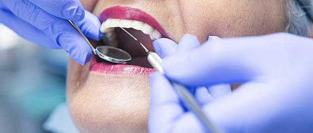 Best Broken or Chipped Tooth Repair in Freeland, PA